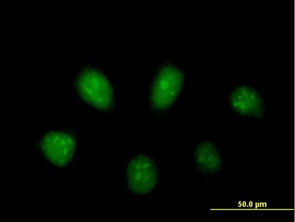 PARP3-Antibody-Immunocytochemistry-Immunofluorescence-H00010039-B01P-img0003-3