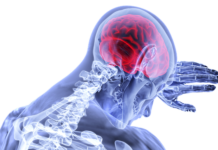 Most advanced brain imaging study in Wales