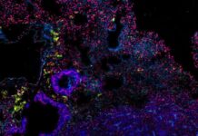 New combination therapy shows early promise against certain lung cancers